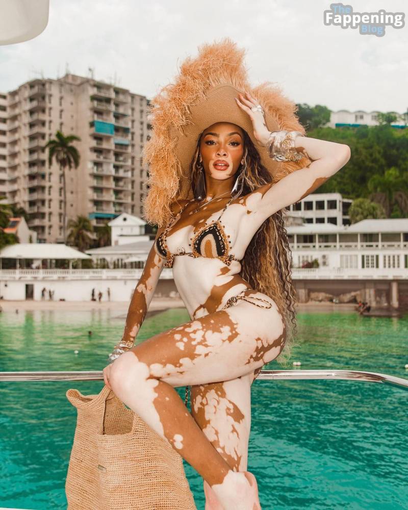 Winnie Harlow Sexy (19 Photos) - #7