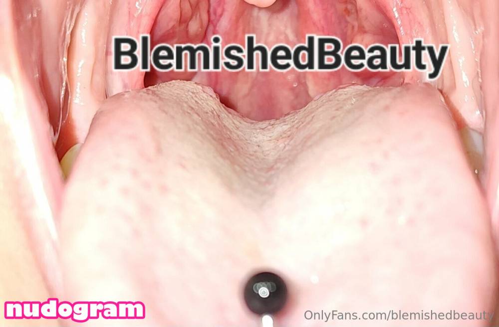 Blemishedbeauty / blemishedbeauty Nude Leaks OnlyFans - TheFap - #5